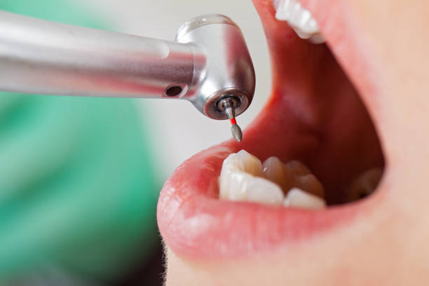 Best Urgent Care for Lost Fillings or Crowns in Trenton, GA